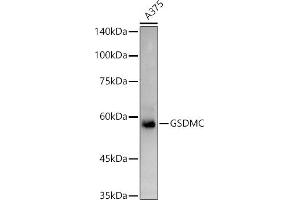 Western blot analysis of extracts of  cells, using GSDMC antibody (ABIN7268463) at 1:1000 dilution. (MLZE 抗体  (AA 1-100))