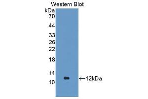 Western Blot; Sample: Recombinant protein. (FGA 抗体  (AA 554-655))