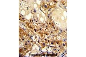 Immunohistochemistry (IHC) image for anti-Cytochrome P450, Family 20, Subfamily A, Polypeptide 1 (CYP20A1) antibody (ABIN3003220) (CYP20A1 抗体)
