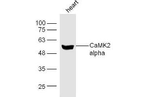 Mouse heart lysates probed with Rabbit Anti-CaMK2 Polyclonal Antibody, Unconjugated  at 1:500 for 90 min at 37˚C (CAMK2B 抗体  (AA 101-200))
