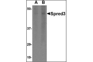 Western blot analysis of Spred3 in human brain tissue lysate with this product at (A) 2 and (B) 4 μg/ml. (SPRED3 抗体  (Center))