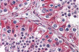 Immunohistochemistry (IHC) image for anti-Proprotein Convertase Subtilisin/kexin Type 6 (PCSK6) (Internal Region) antibody (ABIN308447)