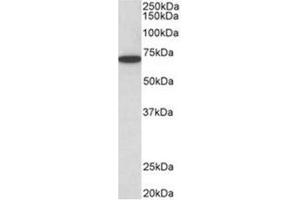 AP31951PU-N HDAC1 antibody staining of HeLa lysate at 0. (HDAC1 抗体  (C-Term))