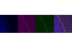 Immunohistochemistry (IHC) image for anti-Corticotropin Releasing Hormone (CRH) antibody (ABIN7455999) (CRH 抗体)