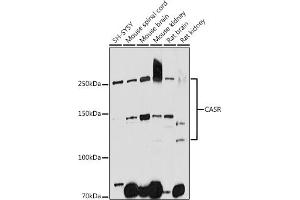 Western blot analysis of extracts of various cell lines, using CASR antibody (ABIN1678994, ABIN5663902, ABIN5663904 and ABIN6218520) at 1:1000 dilution. (CASR 抗体  (AA 874-1088))