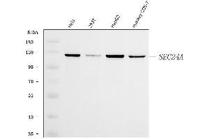 Western blot analysis of SEC24A using anti-SEC24A antibody (ABIN7601709).