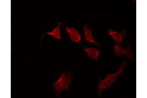 ABIN6267503 staining LOVO by IF/ICC. (STAT3 抗体  (pSer727))