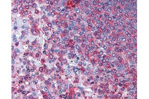 Anti-ACTG1 / Gamma-Actin antibody IHC of human spleen. (Actin, gamma 1 抗体  (AA 1-119))