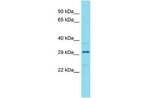 Western Blotting (WB) image for anti-HEAT Repeat Containing 3 (HEATR3) (N-Term) antibody (ABIN2791574)