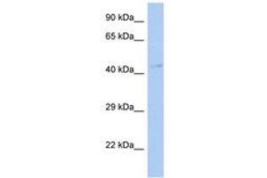 Image no. 1 for anti-Transcription Factor Dp Family, Member 3 (TFDP3) (AA 215-264) antibody (ABIN6742255) (TFDP3 抗体  (AA 215-264))