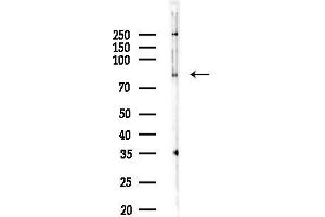 anti-Leucine Rich Repeat and Sterile alpha Motif Containing 1 (LRSAM1) (Internal Region) antibody