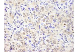 Immunohistochemistry (IHC) image for anti-Casein beta (CSN2) (AA 1-50) antibody (ABIN7448492)