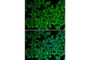 Immunofluorescence analysis of A549 cells using IL12RB1 antibody. (IL12RB1 抗体)