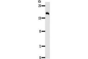 Gel: 8 % SDS-PAGE, Lysate: 40 μg, Lane: Human fetal lung tissue, Primary antibody: ABIN7189710(AFF2 Antibody) at dilution 1/400, Secondary antibody: Goat anti rabbit IgG at 1/8000 dilution, Exposure time: 1 minute (AFF2 抗体)