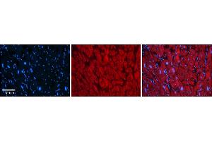 Rabbit Anti-KCNAB2 Antibody    Formalin Fixed Paraffin Embedded Tissue: Human Adult heart  Observed Staining: Cytoplasmic Primary Antibody Concentration: 1:600 Secondary Antibody: Donkey anti-Rabbit-Cy2/3 Secondary Antibody Concentration: 1:200 Magnification: 20X Exposure Time: 0. (KCNAB2 抗体  (Middle Region))