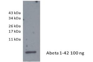 Western Blotting (WB) image for anti-Amyloid beta 1-42 (Abeta 1-42) antibody (ABIN334635) (Abeta 1-42 抗体)