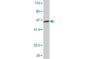 Western Blotting (WB) image for anti-Ribosomal Protein, Large, P0 (RPLP0) (AA 1-317) antibody (ABIN519873)