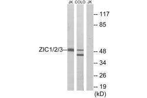 Western blot analysis of extracts from Jurkat cells and COLO cells, using ZIC1/2/3 antibody. (ZIC1 抗体)