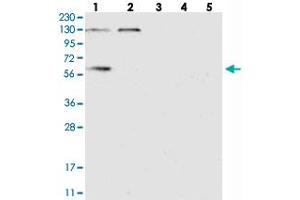Western blot analysis of Lane 1: RT-4, Lane 2: U-251 MG, Lane 3: Human Plasma, Lane 4: Liver, Lane 5: Tonsil with DYNC1LI1 polyclonal antibody  at 1:250-1:500 dilution. (DYNC1LI1 抗体)