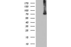 Western Blotting (WB) image for anti-EPM2A (Laforin) Interacting Protein 1 (EPM2AIP1) antibody (ABIN1498045) (EPM2AIP1 抗体)