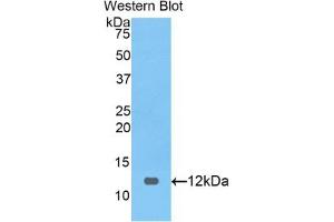 Detection of Recombinant PRAME, Human using Polyclonal Antibody to Preferentially Expressed Antigen In Melanoma (PRAME) (PRAME 抗体  (AA 416-502))
