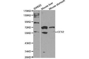 Western blot analysis of extracts of various cell lines, using CES2 antibody. (CES2 抗体  (AA 310-410))