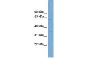 Image no. 1 for anti-Major Facilitator Superfamily Domain Containing 8 (MFSD8) (AA 351-400) antibody (ABIN6745584) (MFSD8 抗体  (AA 351-400))
