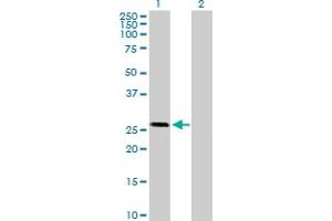Western Blot analysis of OTUB2 expression in transfected 293T cell line by OTUB2 MaxPab polyclonal antibody. (OTUB2 抗体  (AA 1-234))