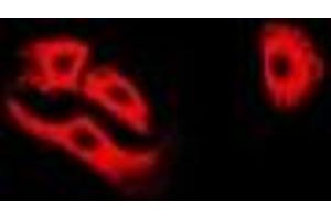 Immunofluorescent analysis of ETFA staining in A549 cells. (ETFA 抗体)