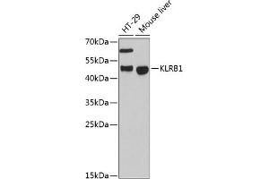 Western blot analysis of extracts of various cell lines, using KLRB1 antibody (ABIN6130055, ABIN6142970, ABIN6142972 and ABIN6222669) at 1:3000 dilution. (CD161 抗体  (AA 73-140))