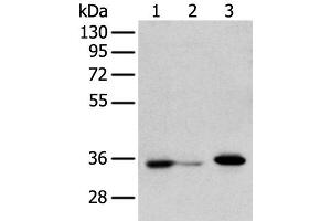 Western blot analysis of HepG2 cell Hela cell and A549 cell using DHRSX Polyclonal Antibody at dilution of 1:350 (DHRSX 抗体)