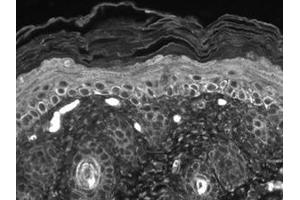 Immunohistochemistry (IHC) image for anti-Transient Receptor Potential Cation Channel, Subfamily C, Member 7 (TRPC7) (C-Term) antibody (ABIN6656403)