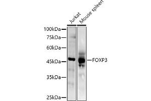 Western blot analysis of extracts of various cell lines, using (ABIN6133706, ABIN6140764, ABIN6140767 and ABIN6215622) at 1:500 dilution. (FOXP3 抗体  (AA 50-150))