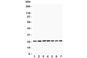Western blot testing of CNTF antibody and rat samples 1:  PC12;  2: NRK;  3: RH35;  4: brain;  5: liver;  6: spleen;  7: testis lysate. (CNTF 抗体  (AA 2-200))