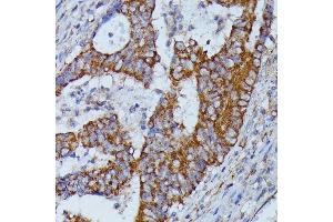 Immunohistochemistry (IHC) image for anti-3-Hydroxy-3-Methylglutaryl-CoA Synthase 2 (Mitochondrial) (HMGCS2) (AA 269-508) antibody (ABIN7265329)