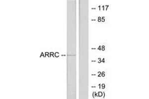 Western blot analysis of extracts from LOVO cells, using ARRC Antibody.