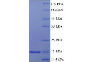 SDS-PAGE (SDS) image for Niemann-Pick Disease, Type C2 (NPC2) (AA 22-149) protein (His tag) (ABIN5711351)