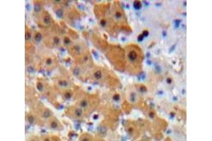 Immunohistochemistry (IHC) image for anti-Proteasome (Prosome, Macropain) Subunit, beta Type, 8 (Large Multifunctional Peptidase 7) (PSMB8) (AA 75-272) antibody (ABIN7440308)