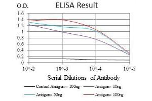 Black line: Control Antigen (100 ng), Purple line: Antigen(10 ng), Blue line: Antigen (50 ng), Red line: Antigen (100 ng), (BMI1 抗体)