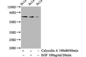 Western Blot Positive WB detected in Hela whole cell lysate(treated with Calyculin A or EGF) All lanes Phospho-RAF1 antibody at 1. (Recombinant RAF1 抗体  (pSer259))