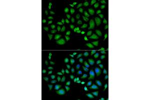 Immunofluorescence analysis of HeLa cells using CLIC1 antibody. (CLIC1 抗体)