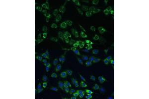 Immunofluorescence analysis of C6 cells using USP46 Polyclonal Antibody (ABIN7271165) at dilution of 1:100 (40x lens). (USP46 抗体)