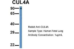 Host: Rabbit  Target Name: CUL4A  Sample Tissue: Human Fetal Lung  Antibody Dilution: 1. (Cullin 4A 抗体  (Middle Region))