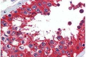 Human Testis (formalin-fixed, paraffin-embedded) stained with  antibody ABIN462273 followed by biotinylated secondary antibody, alkaline phosphatase-streptavidin and chromogen.