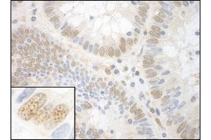 Immunohistochemistry (IHC) image for anti-Nuclear Protein, Ataxia-Telangiectasia Locus (NPAT) (AA 1377-1427) antibody (ABIN7453485)