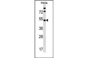 Western blot analysis of IP6K1 Antibody (N-term) in Hela cell line lysates (35ug/lane). (IP6K1 抗体  (N-Term))