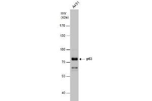 WB Image p63 antibody detects p63 protein by western blot analysis. (p63 抗体)