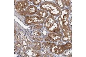 Immunohistochemical staining of human kidney with TPCN1 polyclonal antibody  shows moderate cytoplasmic positivity in cells in renal tubules at 1:20-1:50 dilution. (TPCN1 抗体)