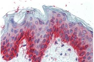 Immunohistochemistry (Paraffin-embedded Sections) (IHC (p)) image for anti-Transcription Factor AP-2 gamma (Activating Enhancer Binding Protein 2 Gamma) (TFAP2C) (AA 252-301) antibody (ABIN6741554)