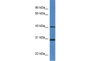 WB Suggested Anti-H13 Antibody   Titration: 1. (H13 抗体  (Middle Region))